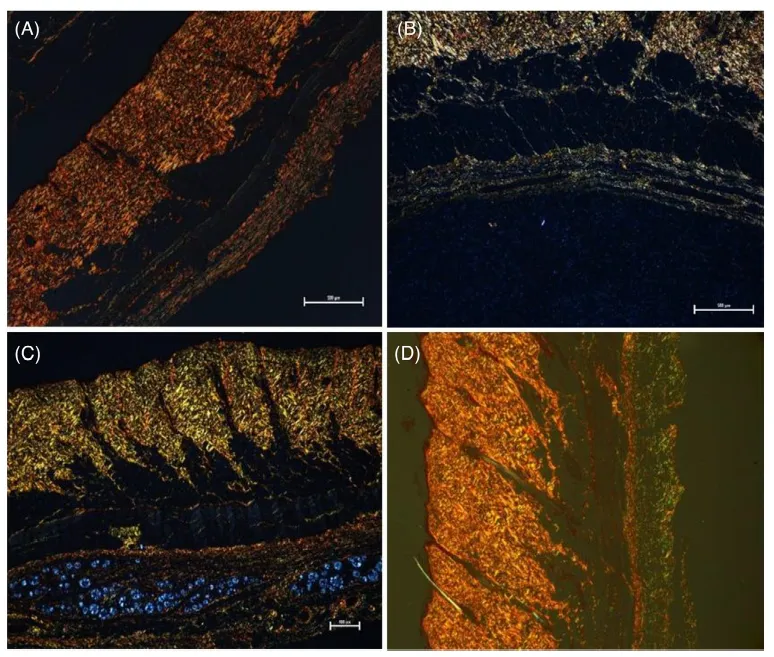 Picrosirius red under polarised light: green is type III collagen, red is type I. Bernardo et al., Skin Research and Technology, 2024 (CC BY 4.0).