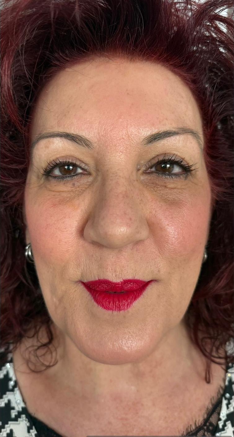 After: Full-face refresh